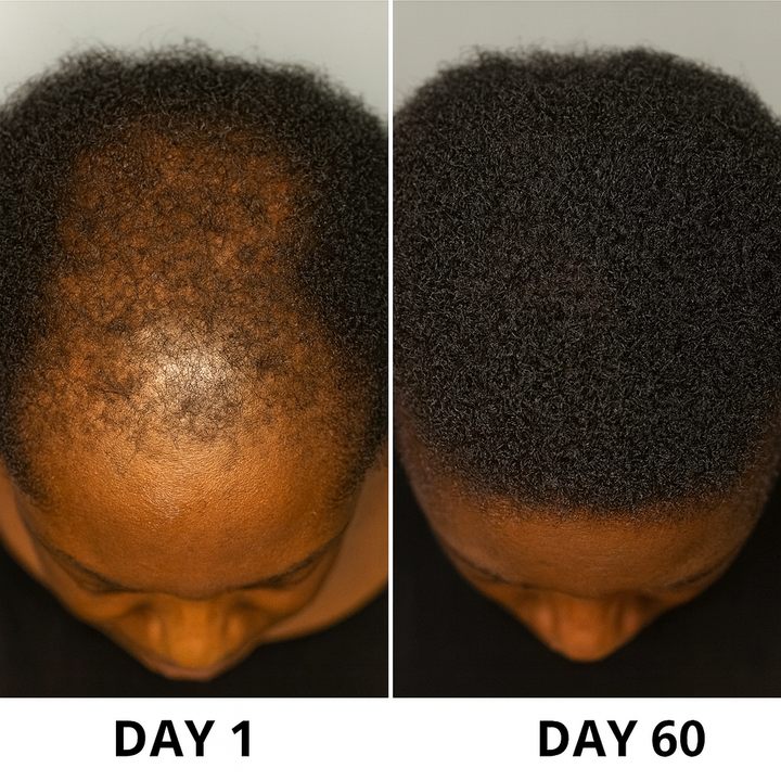 Growth Oil - Scalp & Hair Growth Treatment